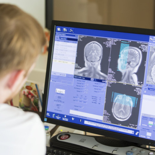 Doi gemeni britanici diagnosticați cu boala MoyaMoya la opt ani distanță